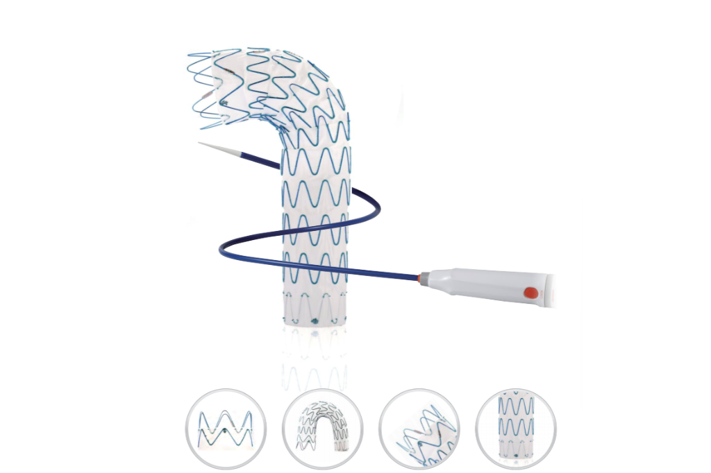 Thoracic Aortic Stent Graft System: Professional Solutions for Complex Aortic Repair